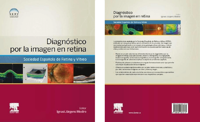 Dr. Jürgens «Diagnóstico por la imagen en retina»