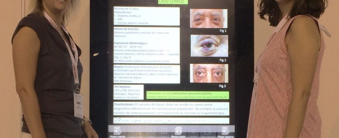 Las doctoras Ibáñez y Cifuentes de oculoplastia - Congreso de la SEO 2016