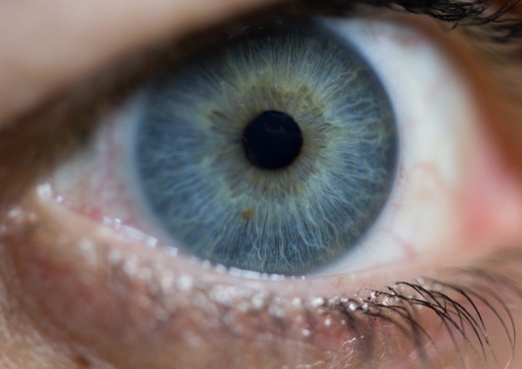 حركة العين و الحول