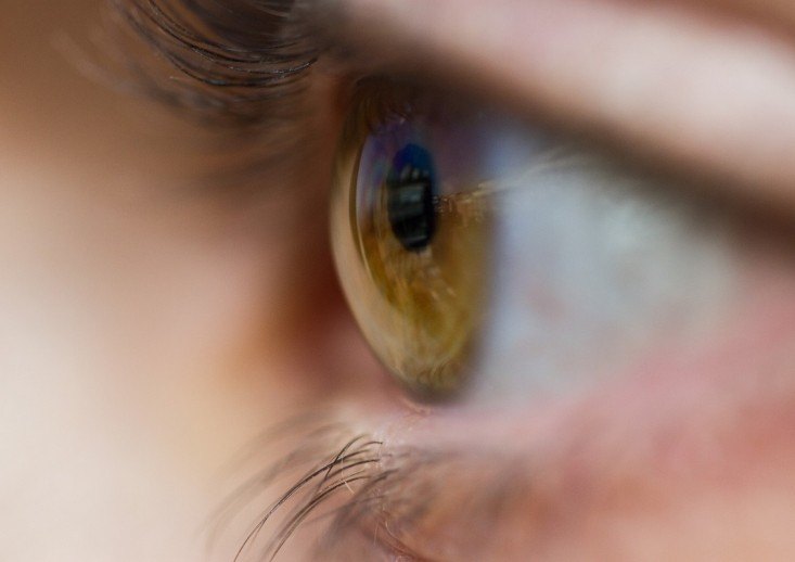 الماء الابيض (الساد)