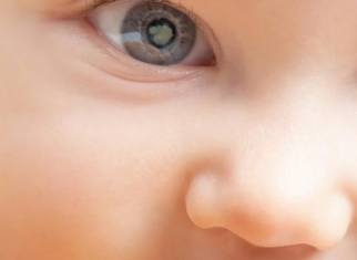 child with cataract | ICR