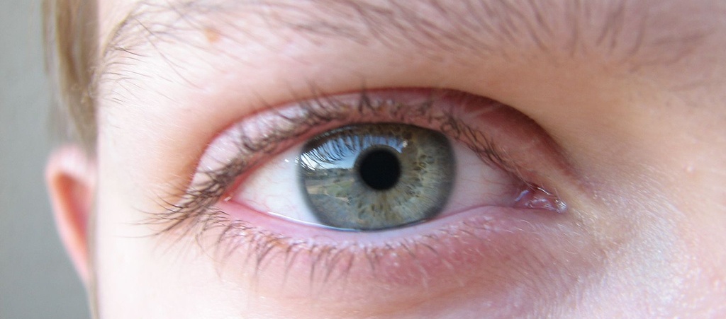 Лучевая или радио терапия