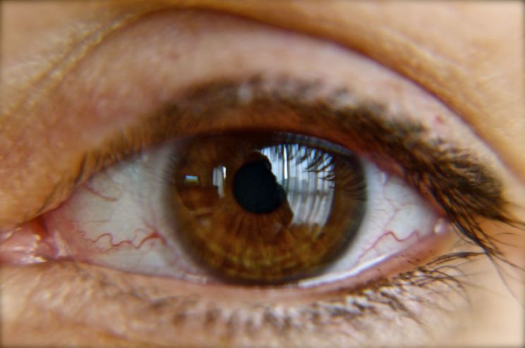 sclera de pigmentare oftalmologie