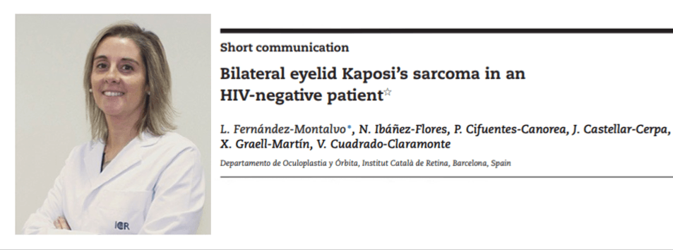 La Dr. Ibáñez publie un article sur le Sarcome de Kaposi palpébral bilatéral dans un patient VIH- négatif