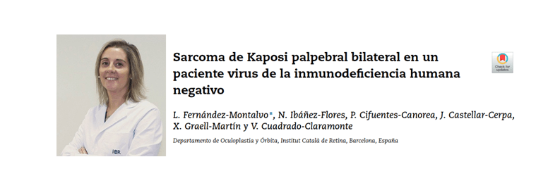 La Dra. Ibáñez publica un article sobre el Sarcoma de Kaposi palpebral bilateral en un pacient VIH-negatiu