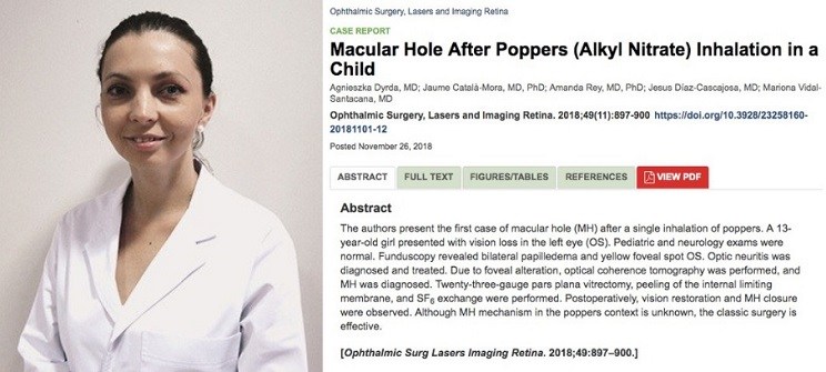 La Dra. Dyrda publica un artículo sobre un caso de agujero macular por inhalación de poppers