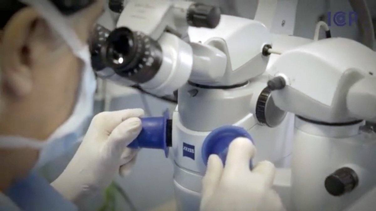 Avantages des équipements les plus innovants pour la chirurgie de la cataracte