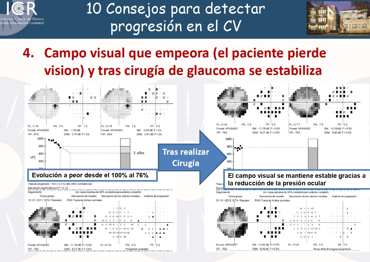 El Dr. Antón ha presentado en el congreso 10 consejos para detectar la progresión de glaucoma