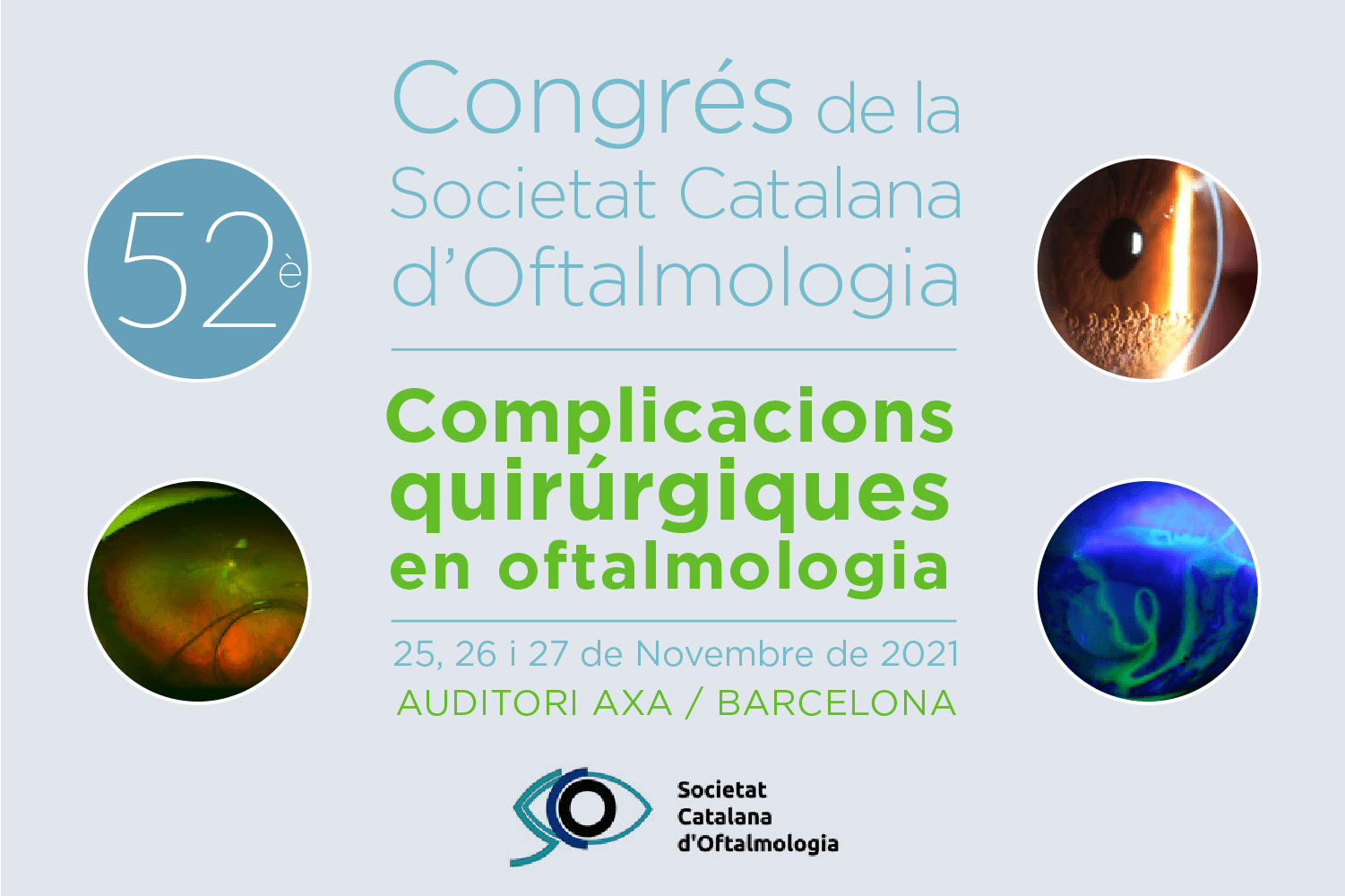 Membres de l’equip de l’ICR participen al 52è Congrés de la Societat Catalana d’Oftalmologia