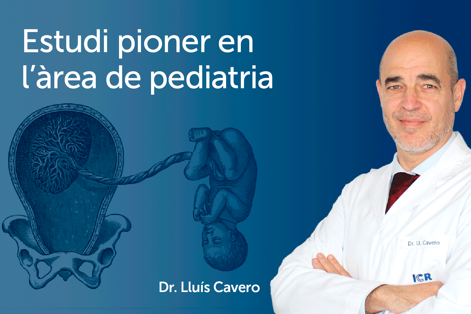 El Dr. Cavero lidera l'estudi que associa malformacions oculars amb artèria umbilical única