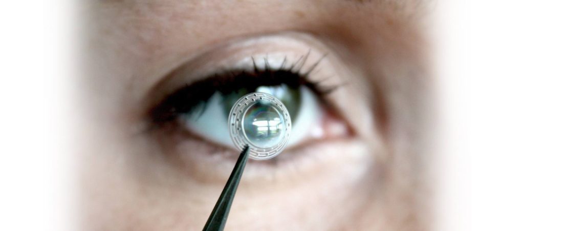 Implant d'anells intracorneals davant d'un ull