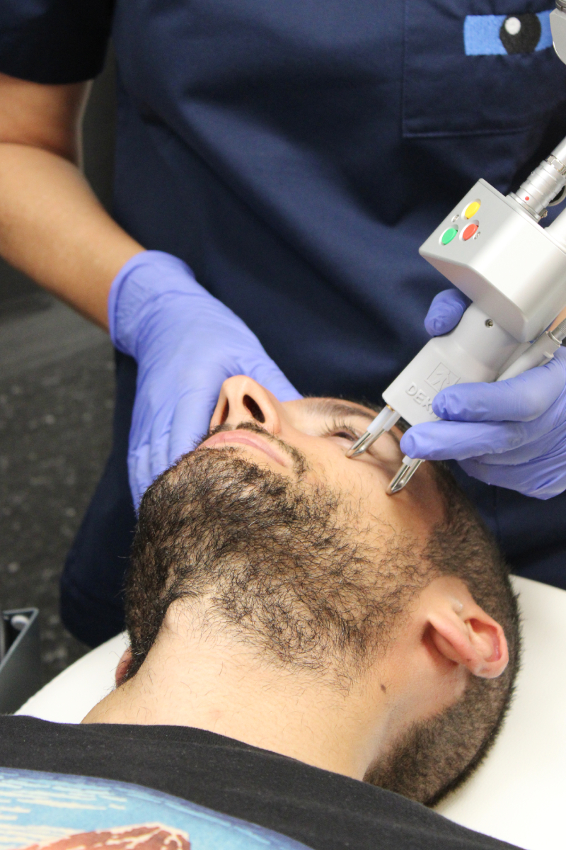 A patient undergoes a treatment with CO2 laser at ICR.