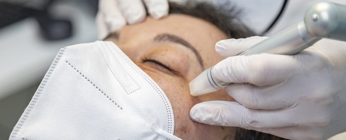 Micro-needling being performed onto a pacient at ICR.