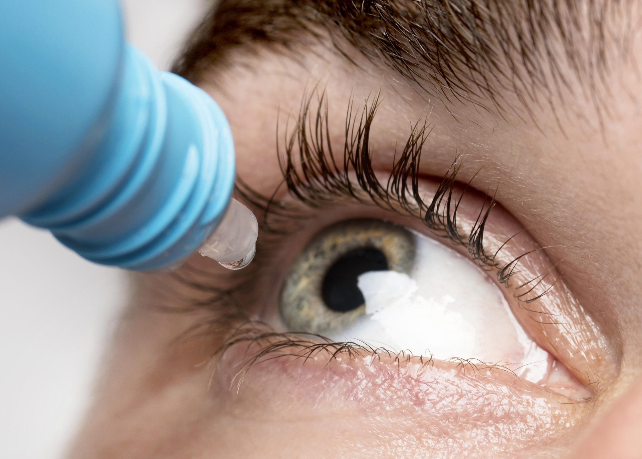 Los colirios son un tratamiento habitual para la conjuntivitis
