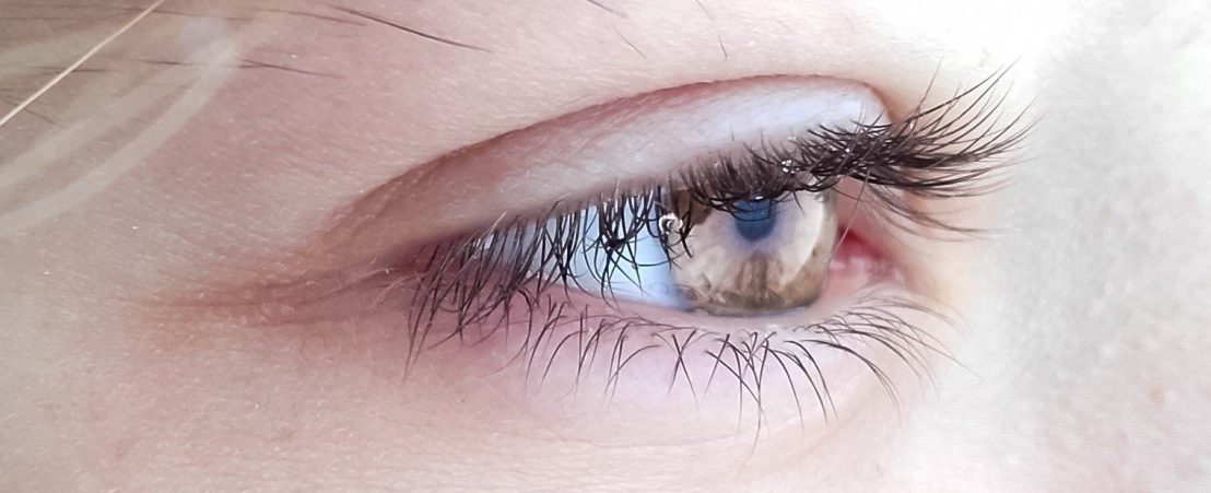 Un párpado entreabierto ejemplifica uno de los tipos de tumores palpebrales y orbitarios