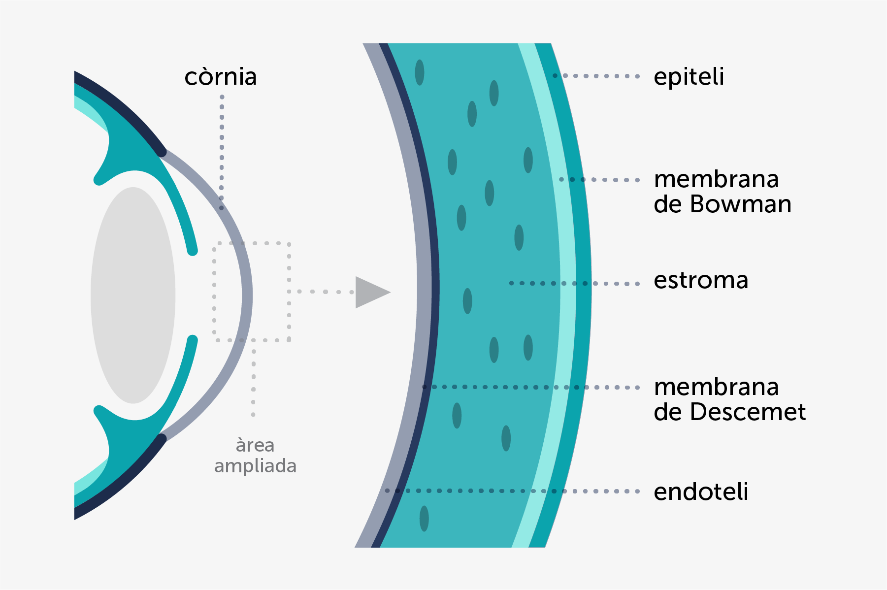 Infografia de les diferents parts de la còrnia i de l'ull involucrades en distròfies corneals.