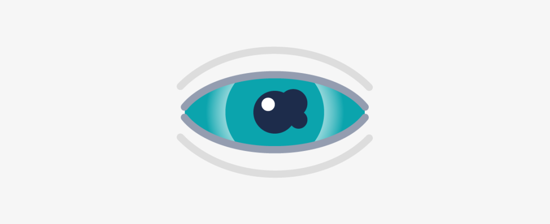 Ilustración esquemática representando un ojo afectado por uveítis.