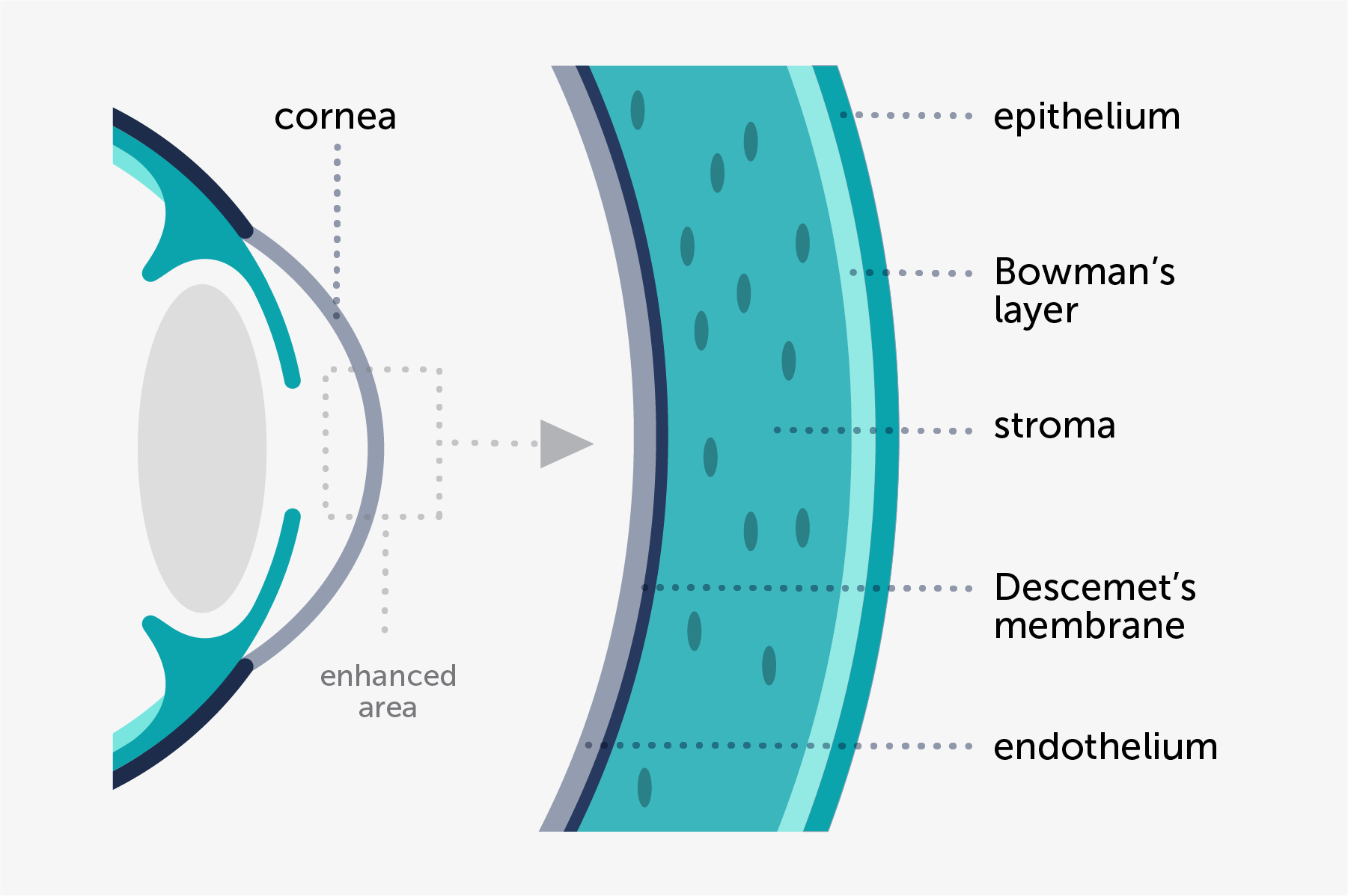 Illustration about the different parts involved in corneal dystrophies